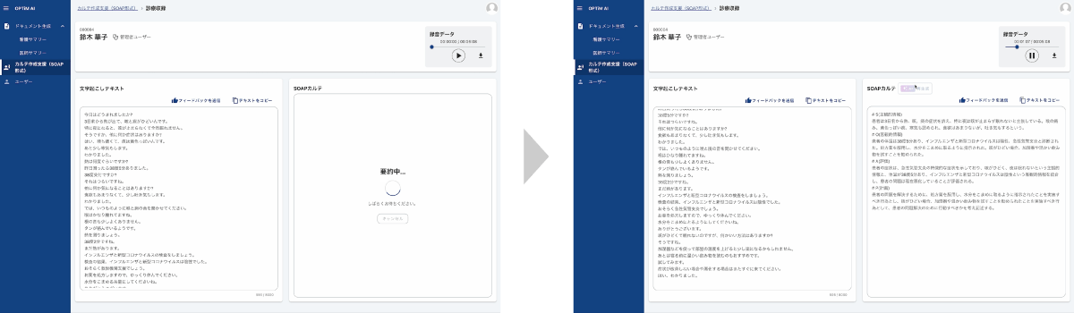 カルテの作成支援β版のイメージ画像